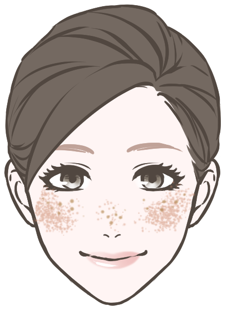肝斑・そばかすが気になる