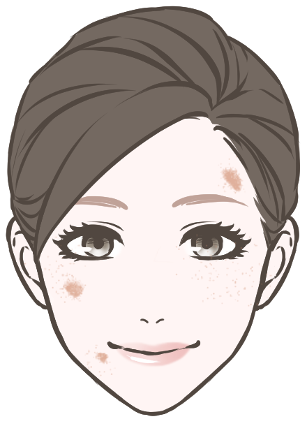 すぐに消したいしみがある