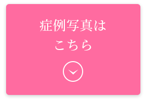 症例写真はこちら