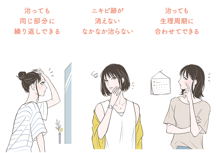 治っても同じ部分に繰り返しできる/ニキビ跡が消えないなかなか治らない/治っても生理周期に合わせてできる