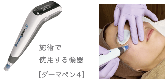 施術で使用する機器【ダーマペン4】