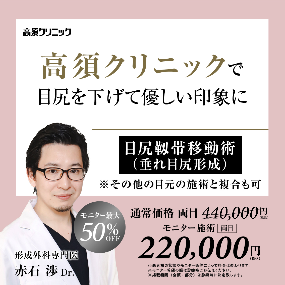 銀座高須クリニック・名古屋院Dr.赤石 渉 モニター募集／目尻靭帯移動術（垂れ目尻形成）※その他目元の施術と複合も可／全顔・部分モニター最大50%OFF