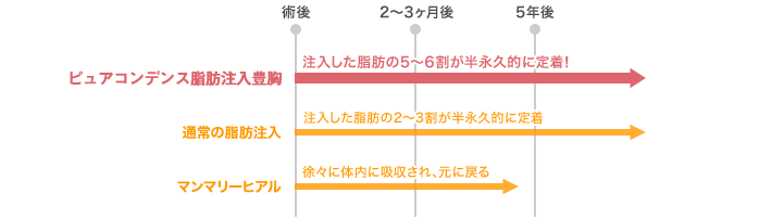 豊胸シリコンバッグプロテーゼを除去と同時に脂肪注入豊胸:注入した脂肪の約5~6割が羽意仇敵に定着! 通常の脂肪注入:注入した脂肪の2~3割が半永久的に定着 マンマリーヒアル<sup>®</sup>(プチ豊胸術・ヒアルロン酸豊胸術):徐々に体内に吸収され、元に戻る