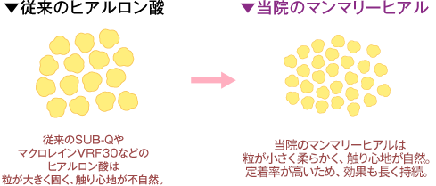 一般的なヒアルロン酸→当院採用のマンマリーヒアル<sup>®</sup>（プチ豊胸術・ヒアルロン酸豊胸術）