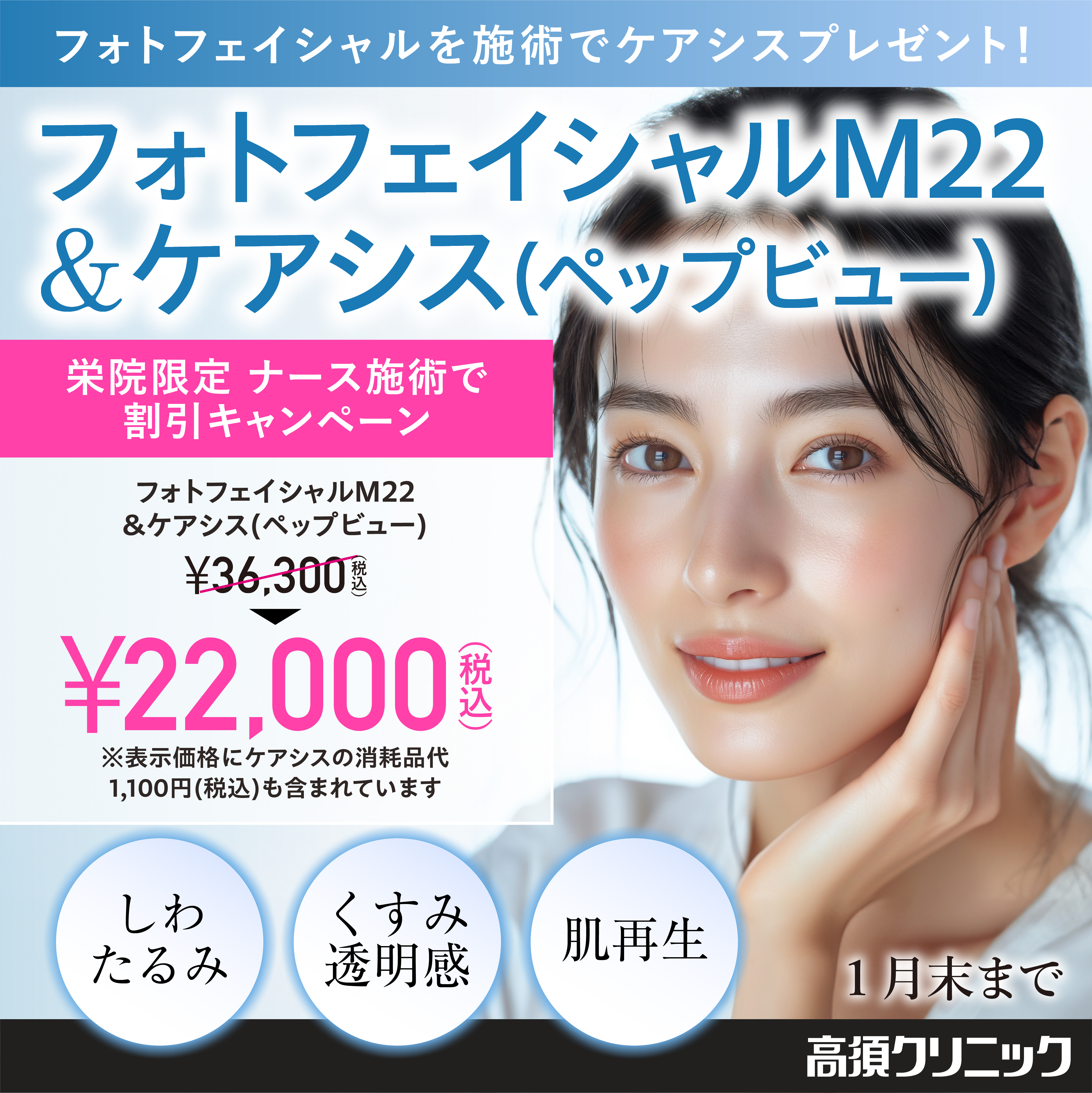 フォトフェイシャルM22＆ケアシス（ペップビュー）/栄院限定　ナース施術で割引キャンペーン/1月末まで