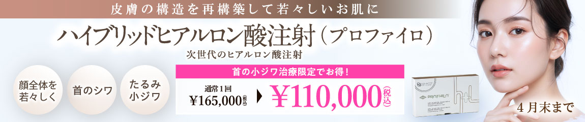 ハイブリッドヒアルロン酸注射 キャンペーン/全院対象/4月末まで