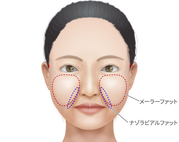 メーラーファットとナゾラビアルファット