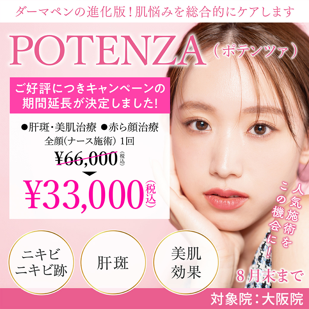 ポテンツァ/肝斑・美肌治療、赤ら顔治療 全顔ナース施術1回 ¥33,000(税込)/大阪院限定/8月末まで