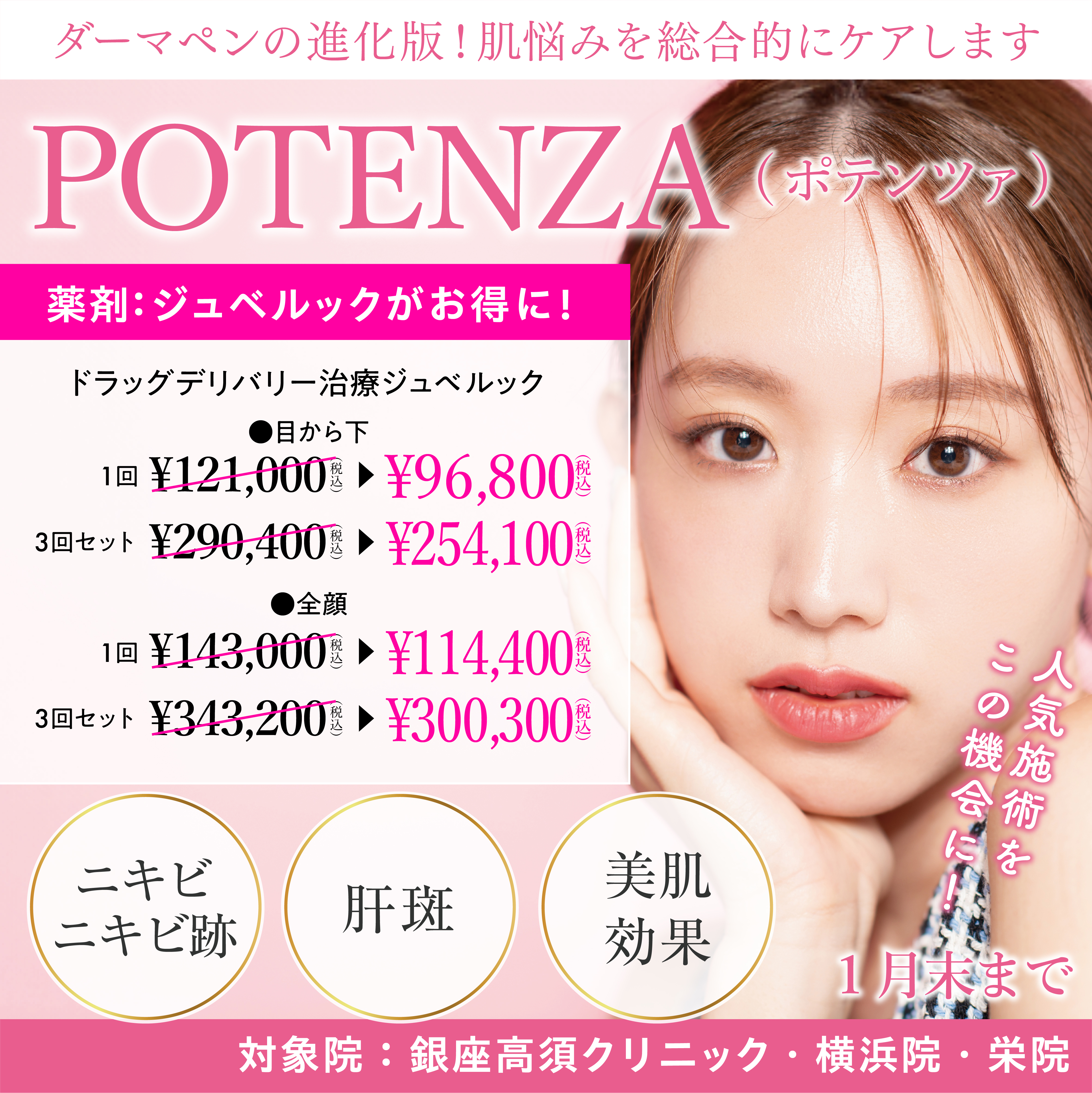 ポテンツァ ドラッグデリバリー 治療 ジュベルック キャンペーン/ジュベルックがお得に！/銀座高須クリニック、横浜院、栄院限定/1月末まで