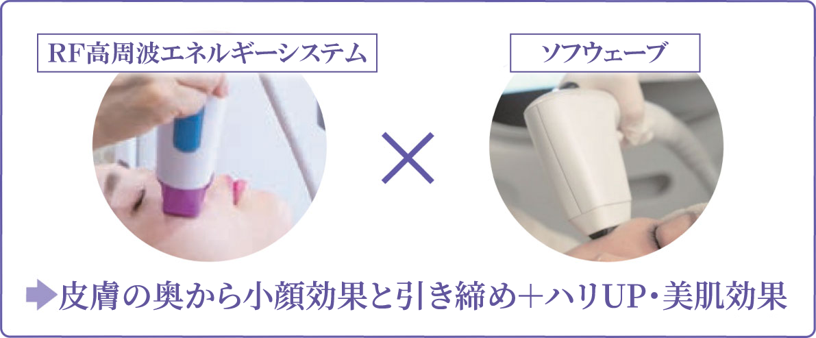 RF高周波エネルギーシステム×ソフウェーブ 皮膚の奥から小顔効果と引き締め＋ハリUP・美肌効果