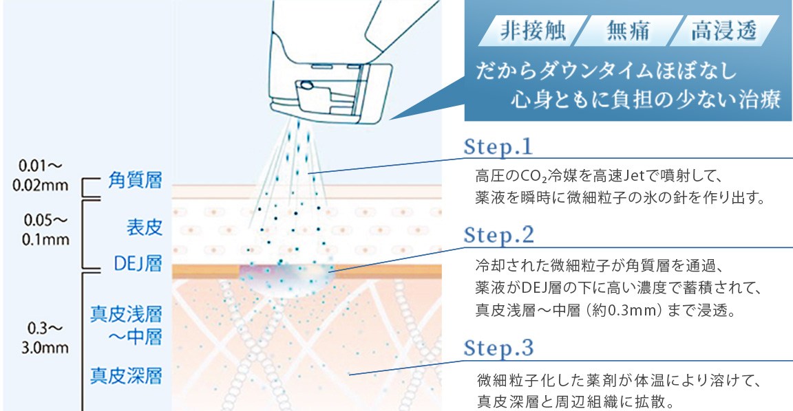 ターゲットクールの特徴1