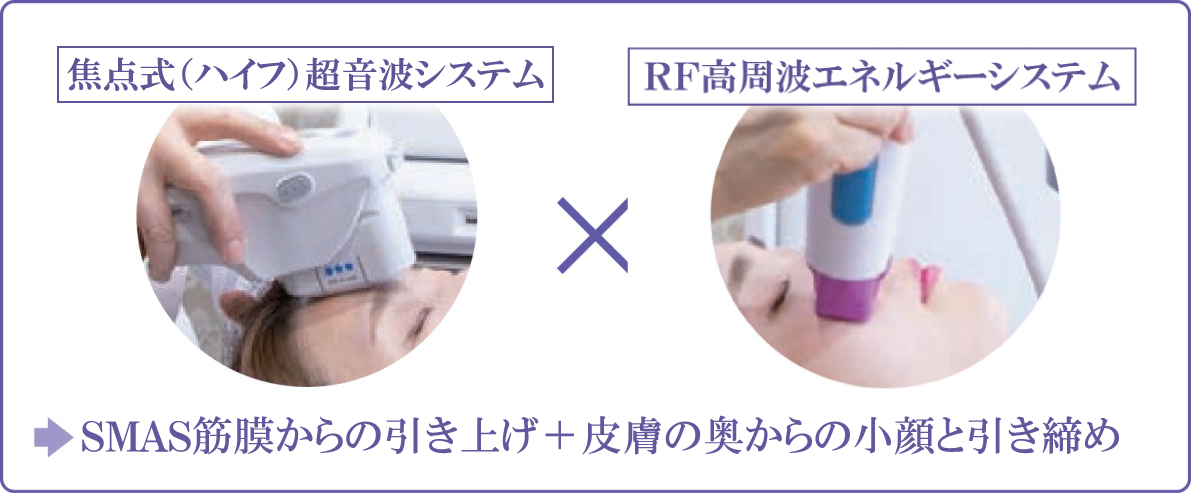 焦点式（ハイフ）超音波システム×RF高周波エネルギーシステム SMAS筋膜からの引き上げ＋皮膚の奥からの小顔と引き締め