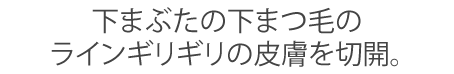 下まぶたの下まつ毛のラインギリギリの皮膚を切開。