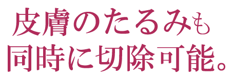 皮膚のたるみも同時に切除可能。