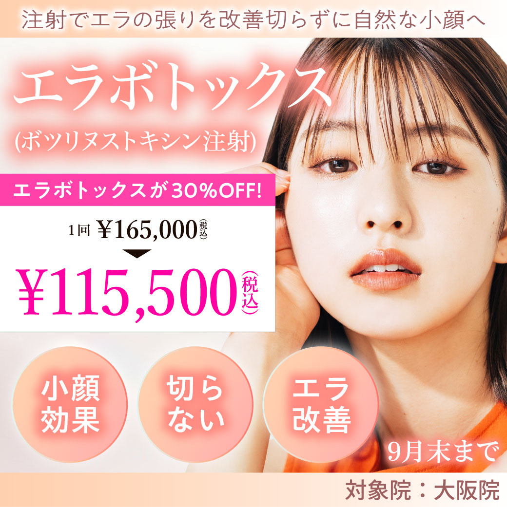 エラボトックス キャンペーン/エラボトックスが30%OFF!/大阪院限定/9月末まで