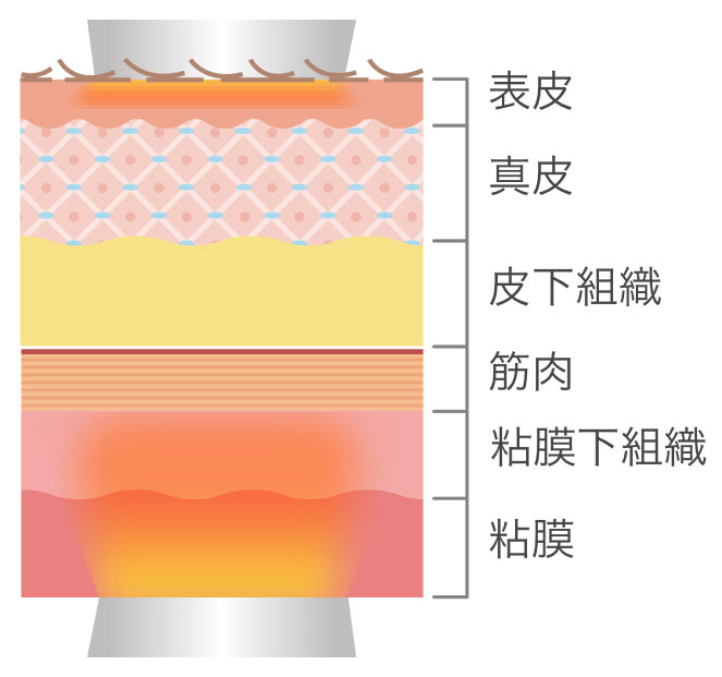 表皮、真皮、皮下組織、筋肉、粘膜下組織、粘膜