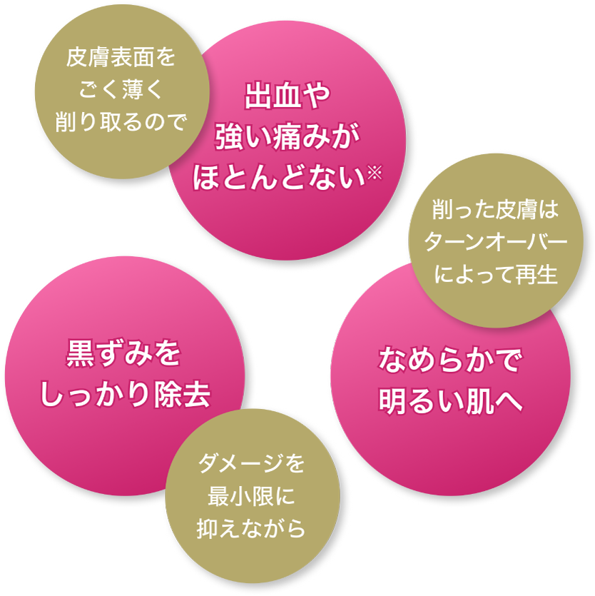ダメージを最小限に抑えながら黒ずみをしっかり除去/皮膚表面をごく薄く削り取るので出血や強い痛みがほとんどない※/削った皮膚はターンオーバーによって再生 なめらかで明るい肌へ