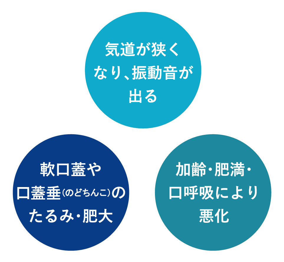 軟口蓋や口蓋垂（のどちんこ）のたるみ・肥大/気道が狭くなり、振動音が出る/加齢・肥満・口呼吸により悪化