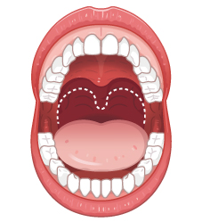 レーザーで引き締めるので切らないから痛くない。