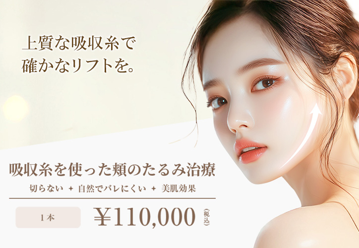 吸収糸を使った頬のたるみ治療／切らない・自然でバレにくい・美肌効果／1本 110,000円（税込）